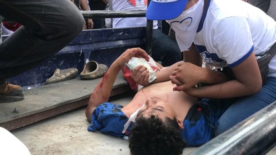 Nicaragua: Ortega masacra la “madre” de las marchas pacíficas