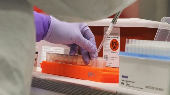 Analiza hasta 1.400 test diarios: principal laboratorio público se queda sin insumo para procesar exámenes Covid